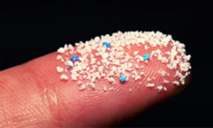 Phát hiện vi nhựa có thể liên quan đột quỵ Phát hiện vi nhựa có thể liên quan đột quỵ