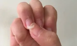 Dấu hiệu cảnh báo rối loạn nội tiết tố