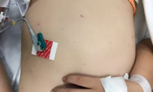 Cách nào nhận biết sớm bệnh não gây tử vong trong 24 giờ? Cách nào nhận biết sớm bệnh não gây tử vong trong 24 giờ?